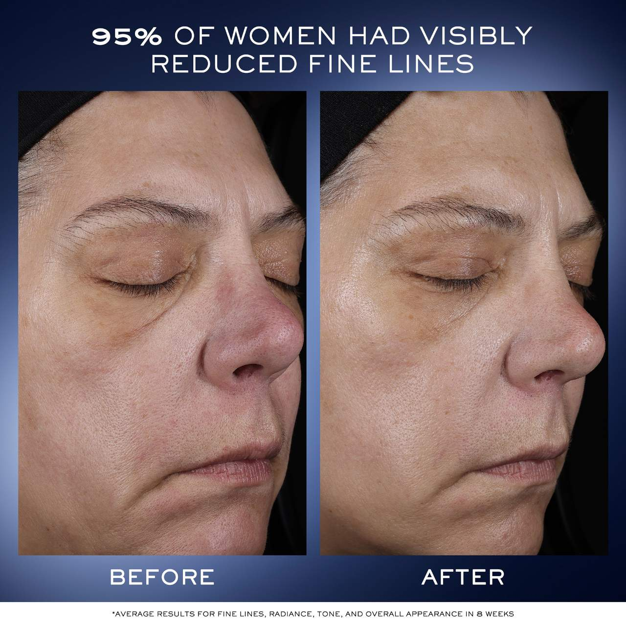 Génifique Ultimate Recovery Serum for Skin Barrier Repair