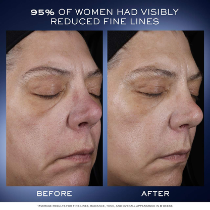 Génifique Ultimate Recovery Serum for Skin Barrier Repair