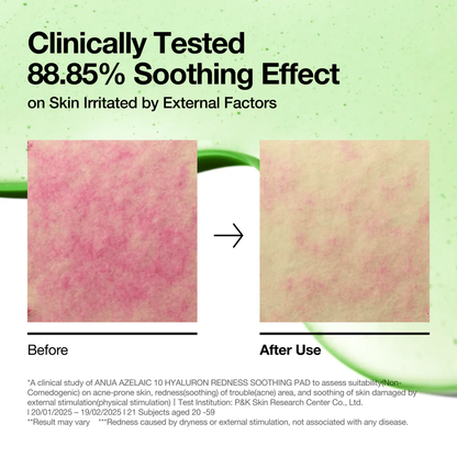 Azelaic 10 Hyaluron Redness Soothing Pad 230ml