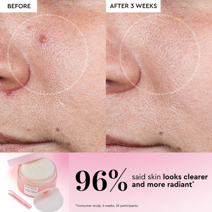 LHA + AHA Korean Watermelon Toner Pads
