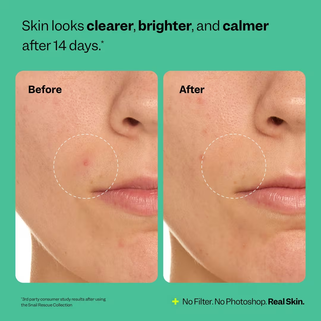 Snail Rescue Purifying Cleanser