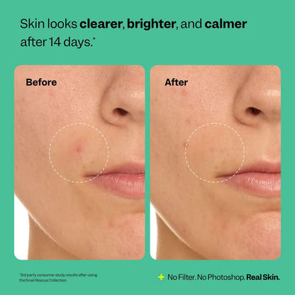 Snail Rescue Purifying Cleanser