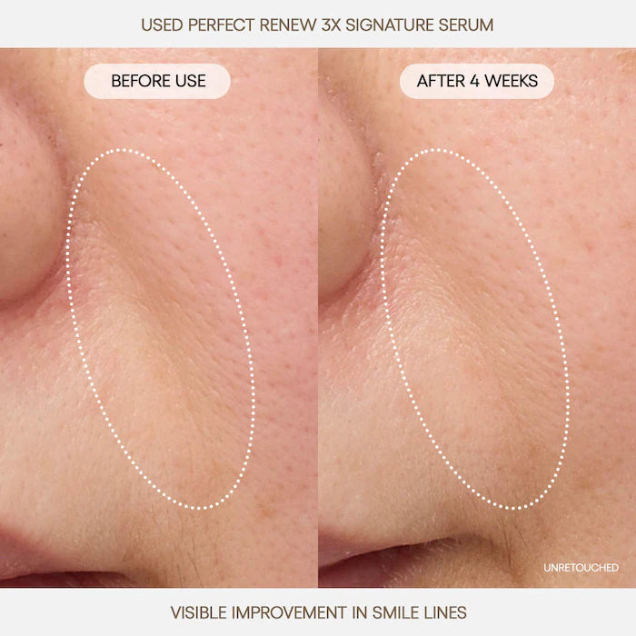 LANEIGE 
Perfect Renew 3x Signature Serum Advanced for Anti-Aging, Firming & Lifting